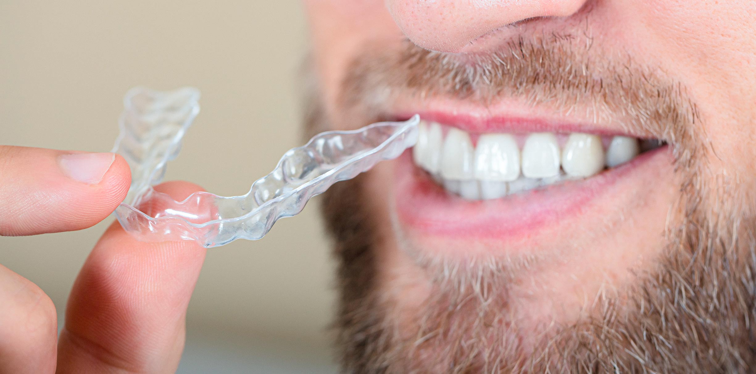 Mann hält eine unsichtbare Zahnspange vor seine Zähne